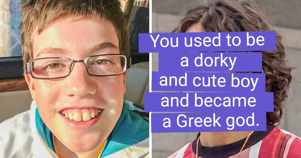 16 People Who Blossomed Into Beautiful Swans After Their Teenage Years Had Passed