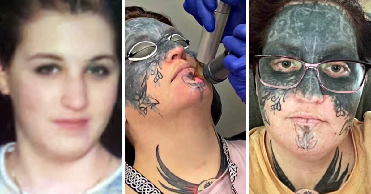 A Woman Whose Face Was Tattooed Experiences “Life Change” After a Stranger Offers to Help With Removal