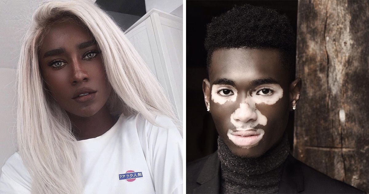 14 People Who Look So Magnetic, We Want to See Them With Our Own Eyes