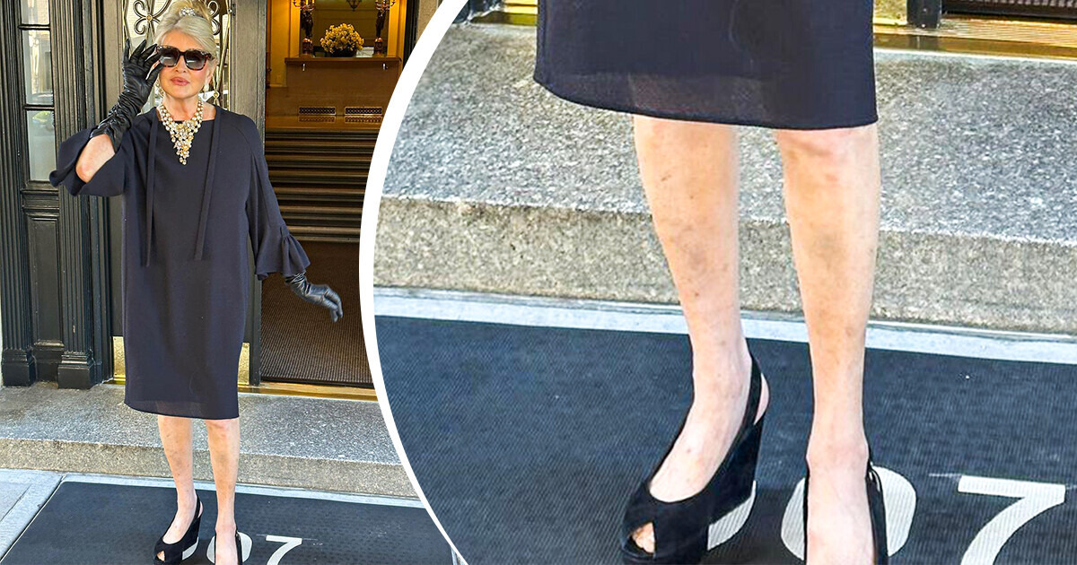 Martha Stewart, 82, Slammed for Showing Off Her Legs in an Instagram Post Martha Stewart, 82, Slammed for Showing Off Her Legs in an Instagram Post