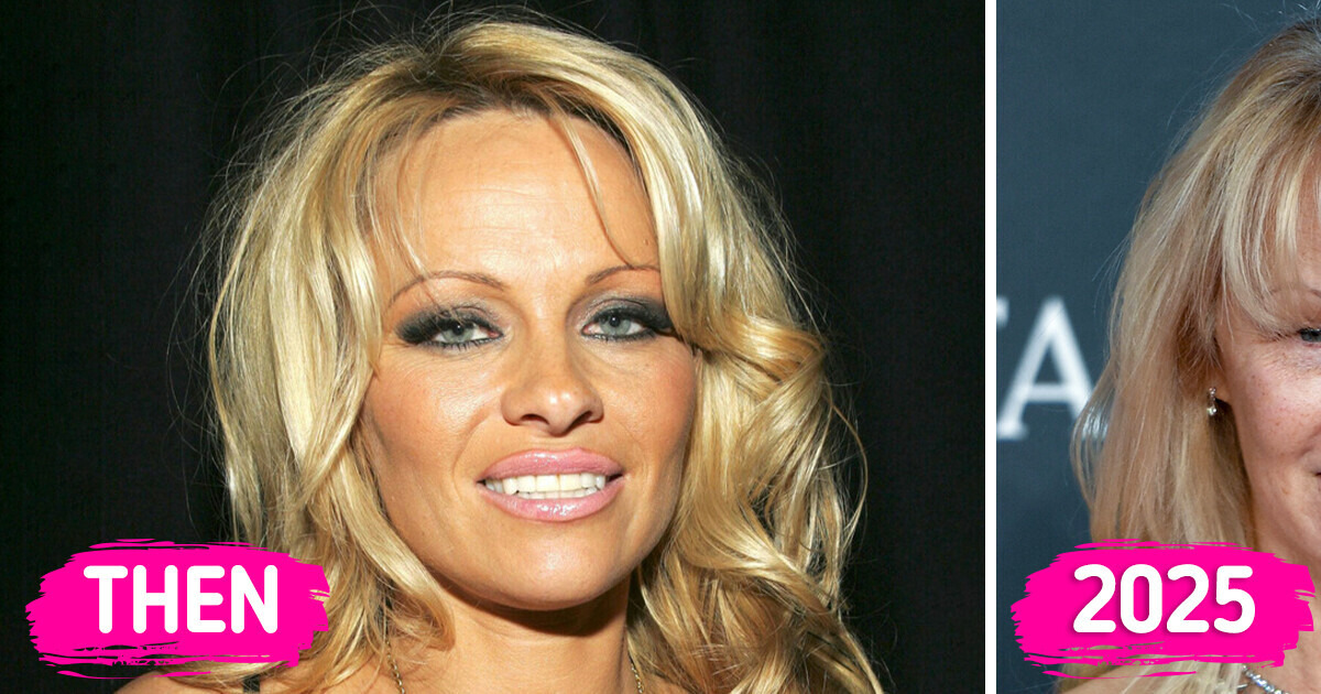 “She Looks Way Older,” Pamela Anderson Rocks Another Barefaced Look on the 2025 BAFTA Red Carpet “She Looks Way Older,” Pamela Anderson Rocks Another Barefaced Look on the 2025 BAFTA Red Carpet