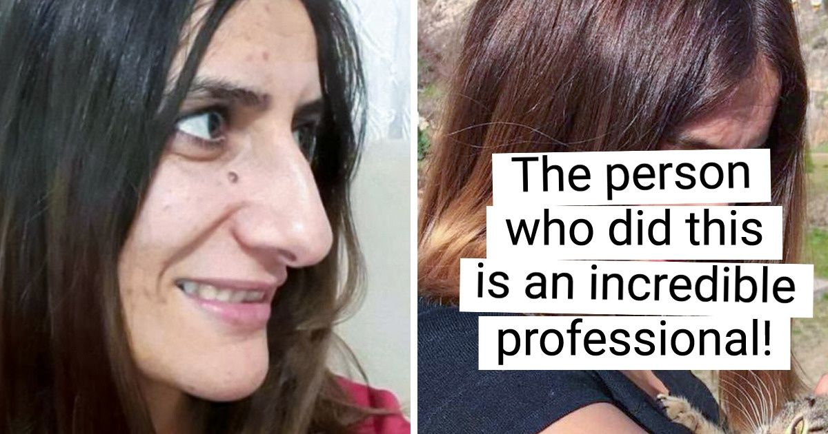 20+ Girls Who Decided to Get Plastic Surgery and Proved There Are No Limits When It Comes to Perfection 20+ Girls Who Decided to Get Plastic Surgery and Proved There Are No Limits When It Comes to Perfection