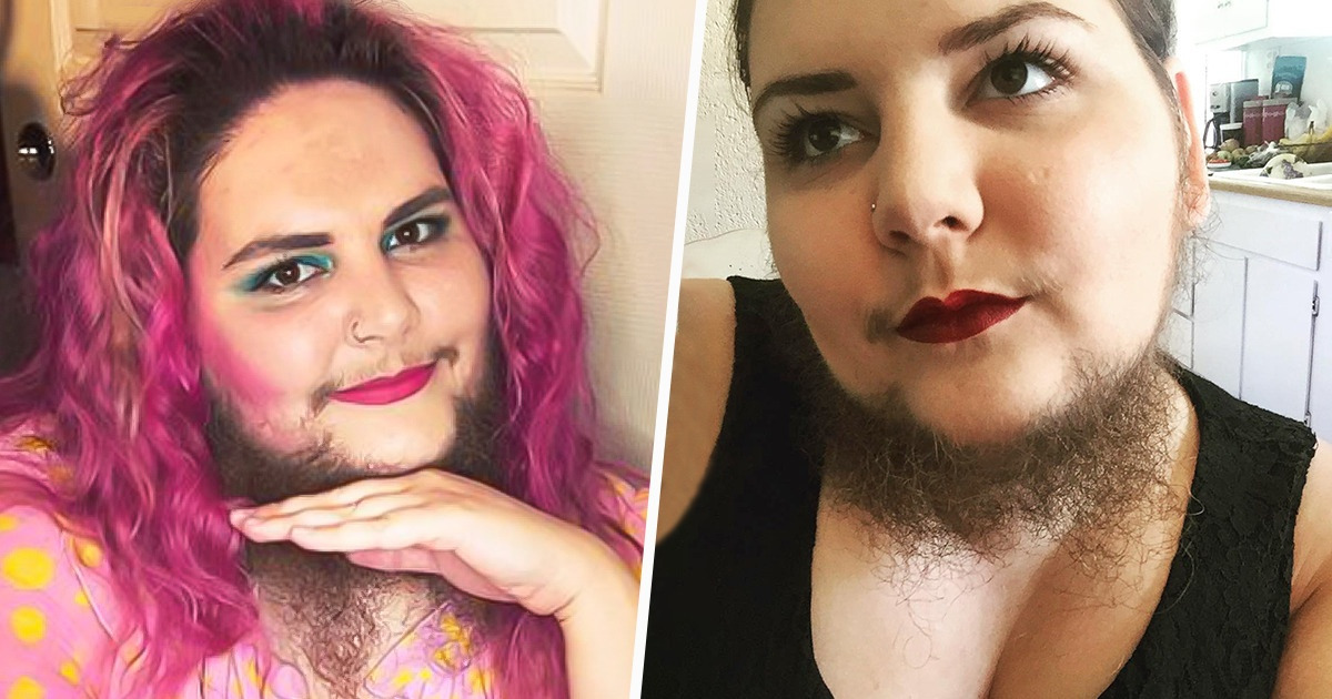 A Woman Stopped Removing Facial Hair And a Year Later Shares How It Changed  Her Life / Bright Side