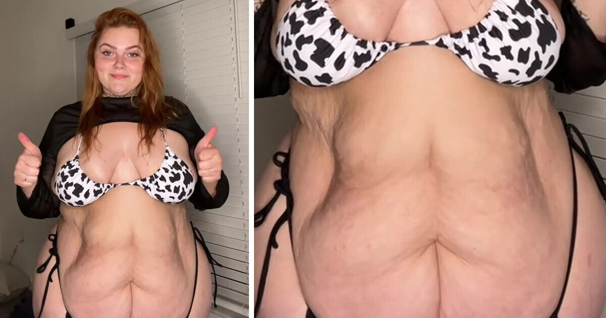 It's a Stomach, It's a Part of Me and I Love It,” This Woman Shares How She  Celebrates Her Fupa / Bright Side