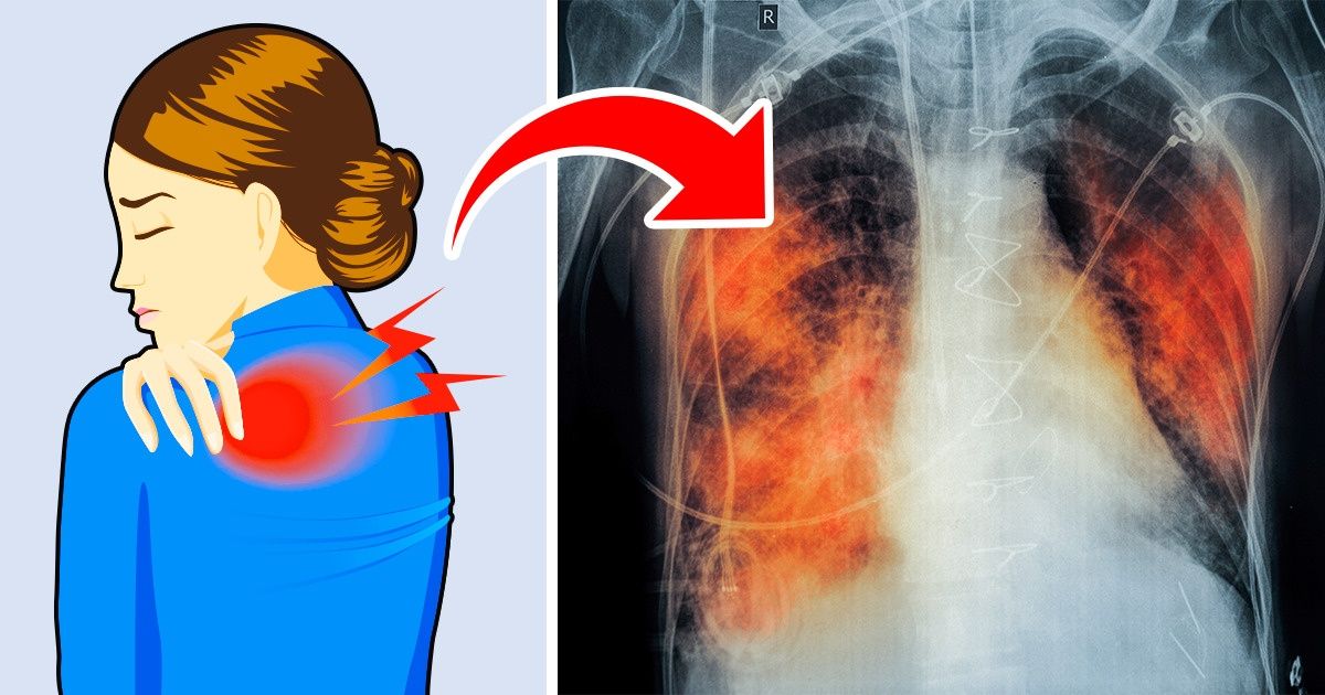 5 Signs Your Lungs Are Gasping For Help Bright Side