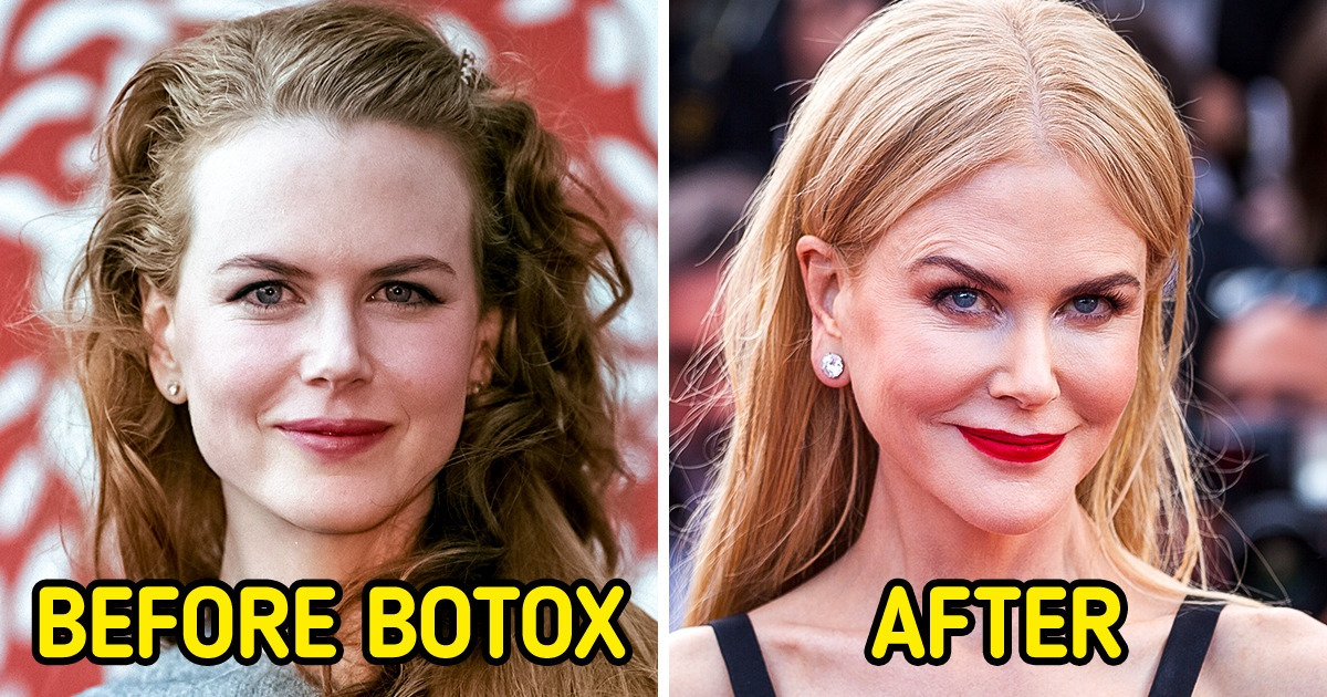 16 Celebrities Who Regretted Their Cosmetic Procedures