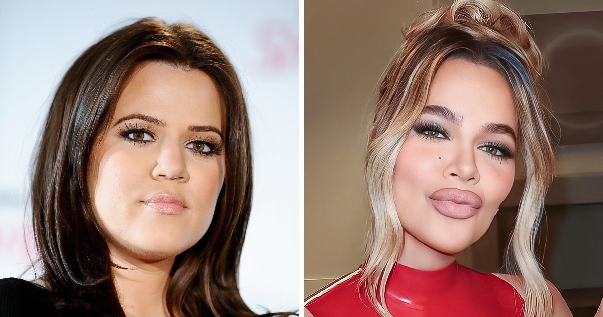 Khloé Kardashian Has a Tumor Removed From Her Face 19 Years After Another Skin Cancer Scare