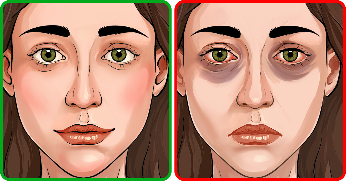 4 Signs of Asthma You Might Not Realize You Have 4 Signs of Asthma You Might Not Realize You Have