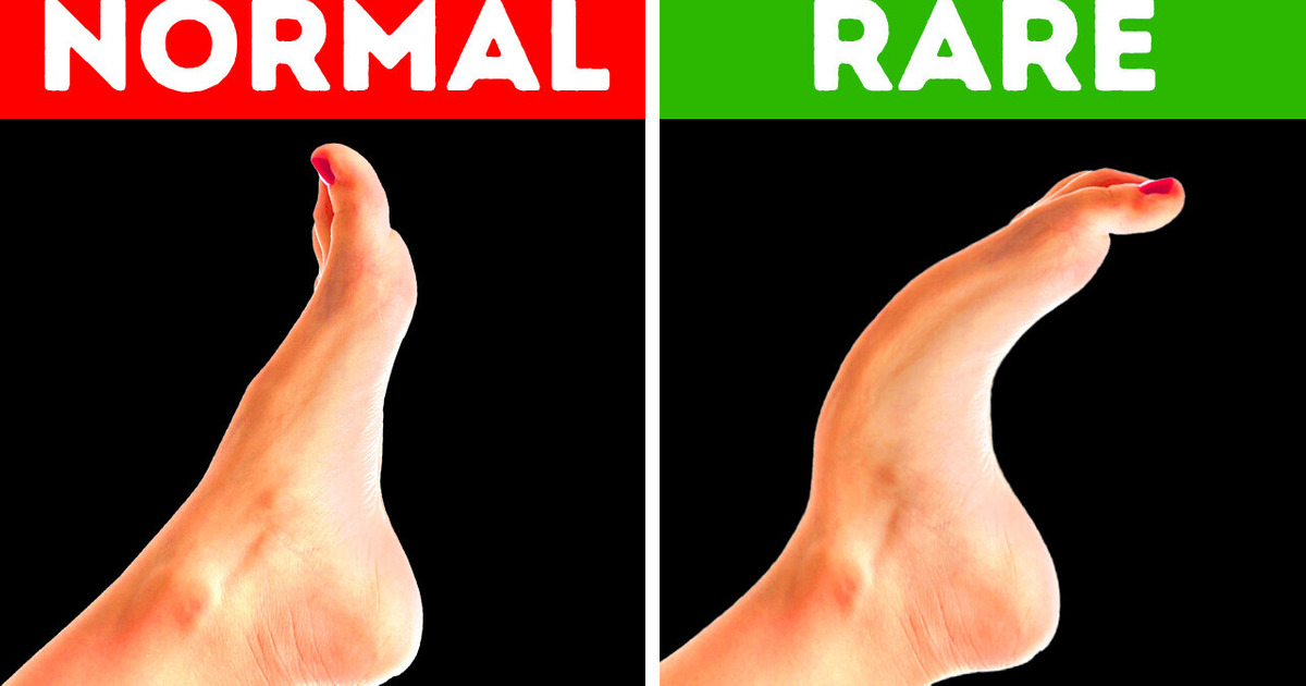 Only 8% of People Have This Body Feature + 17 Rare Body Features Only 8% of People Have This Body Feature + 17 Rare Body Features