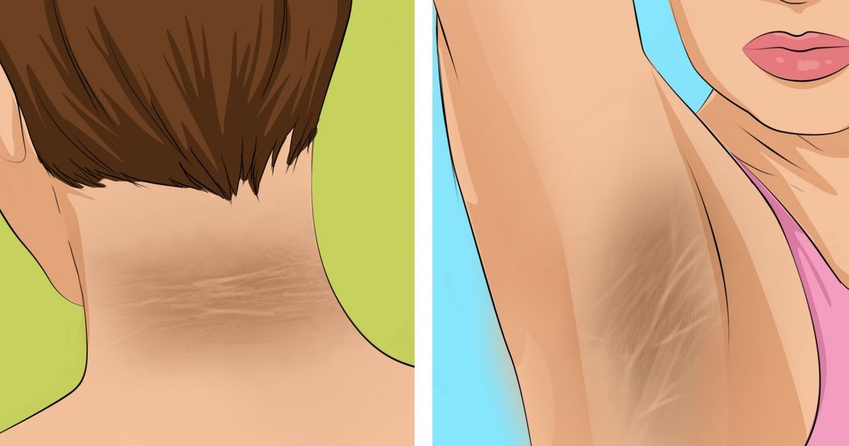 9 Early Symptoms of Diabetes to Recognize for a Timely Diagnosis 9 Early Symptoms of Diabetes to Recognize for a Timely Diagnosis