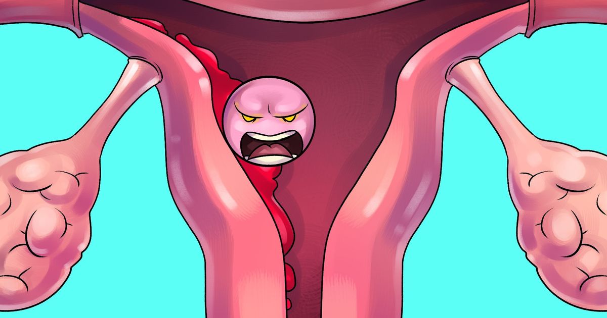 12 Ways to Avoid Period Cramps and Survive That Time of the Month