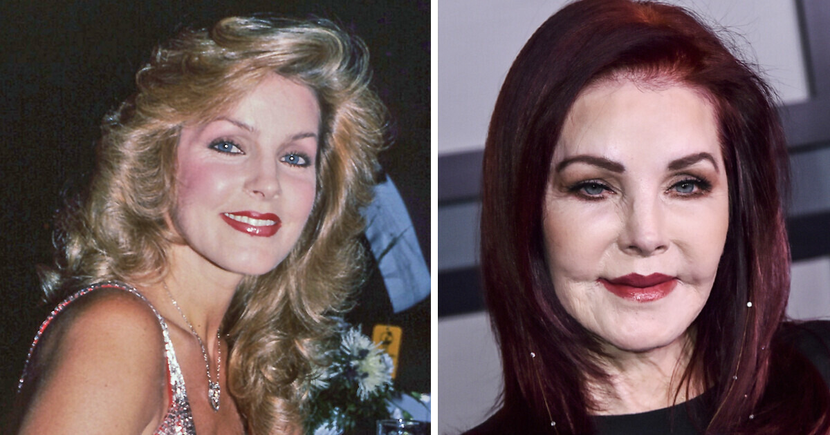 Celebrities Speak Out About Plastic Surgery: Before, After Pics