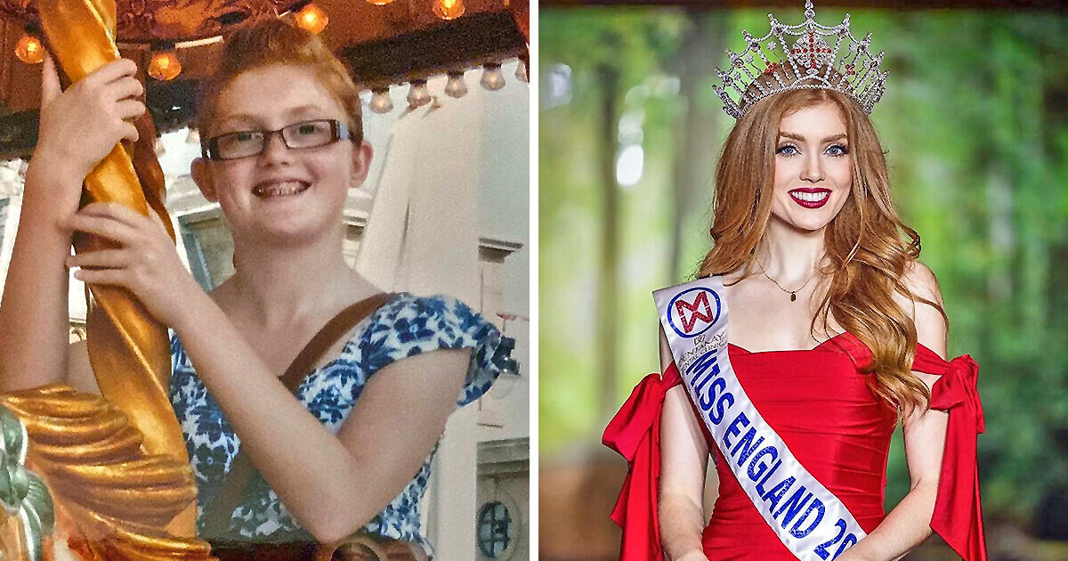 A Lady Was Bullied For Her Looks Now Becomes The First Redhead To Be