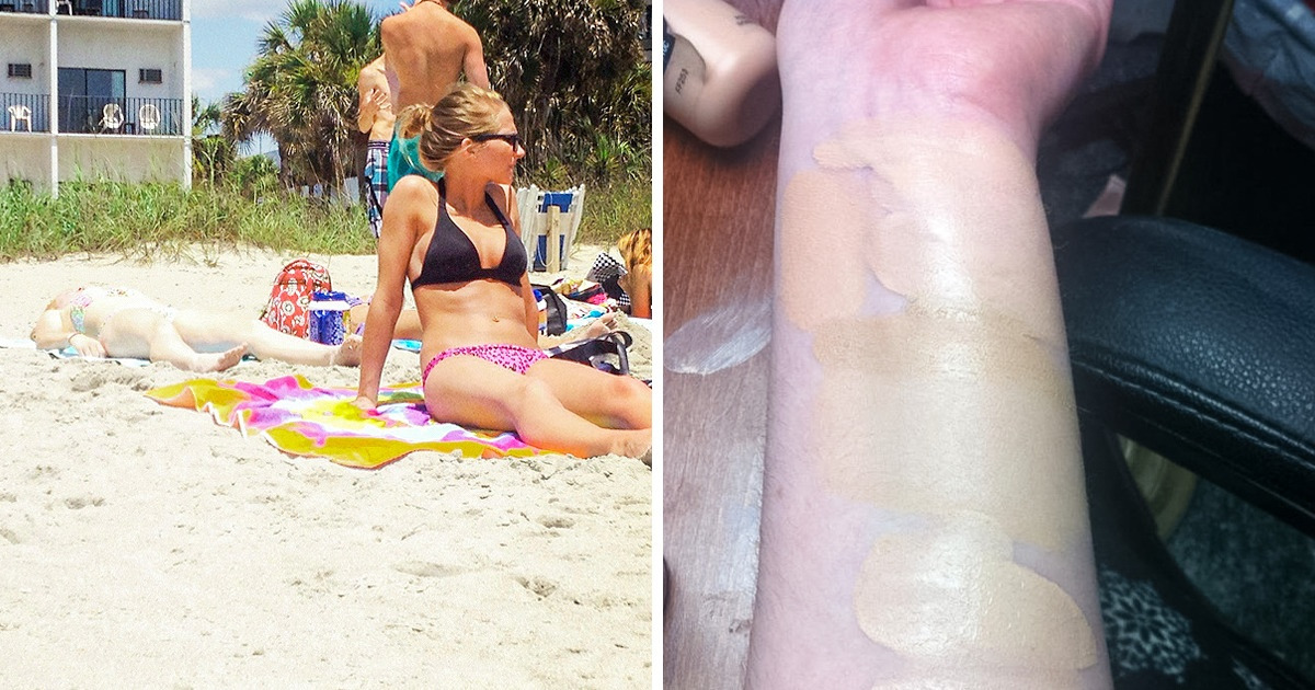 13 Problems Only Pale People Will Understand 13 Problems Only Pale People Will Understand