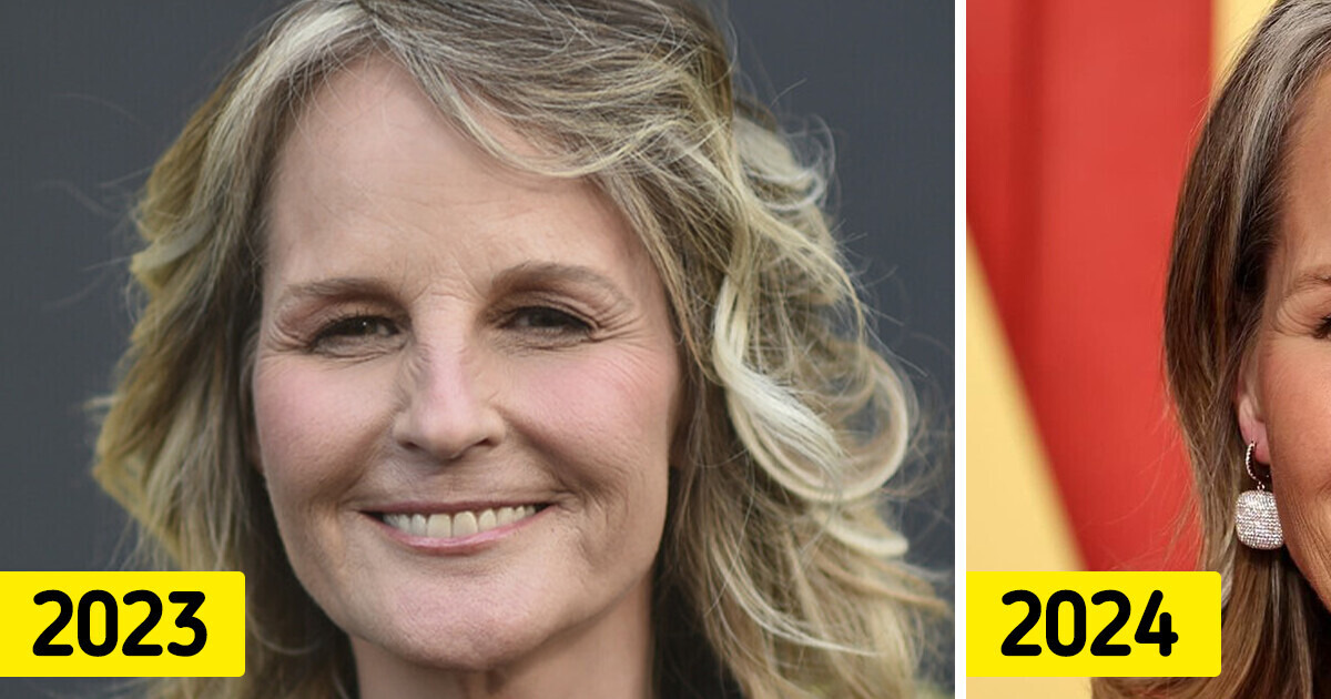 Helen Hunt, 60, Leaves the Internet Stunned in Recent Appearance and Everybody’s Talking About Her Lips Helen Hunt, 60, Leaves the Internet Stunned in Recent Appearance and Everybody’s Talking About Her Lips