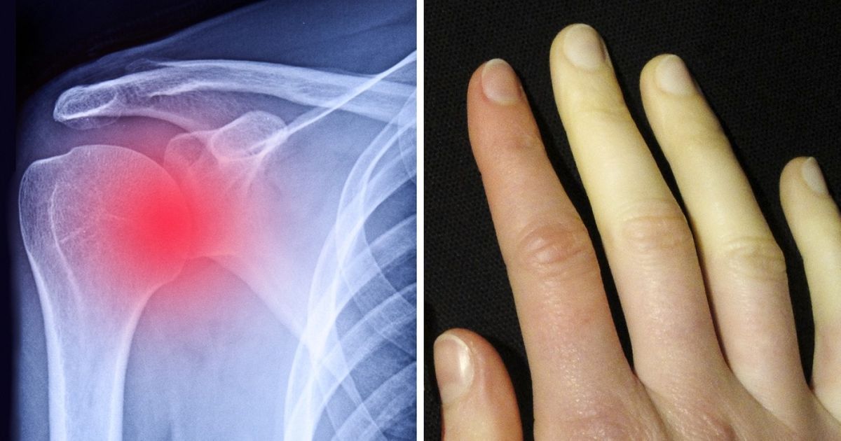 10 Signals From Our Bodies That Need to Be Taken Seriously