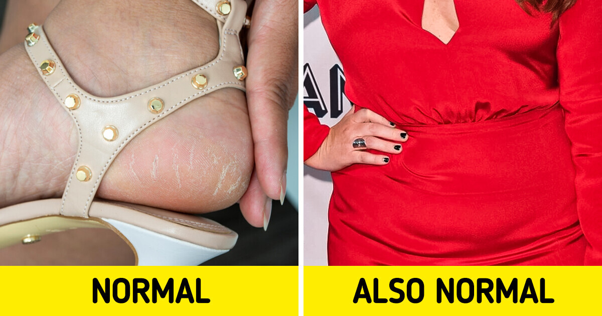 16 Normal Things That Women Should Not Feel Insecure About 16 Normal Things That Women Should Not Feel Insecure About