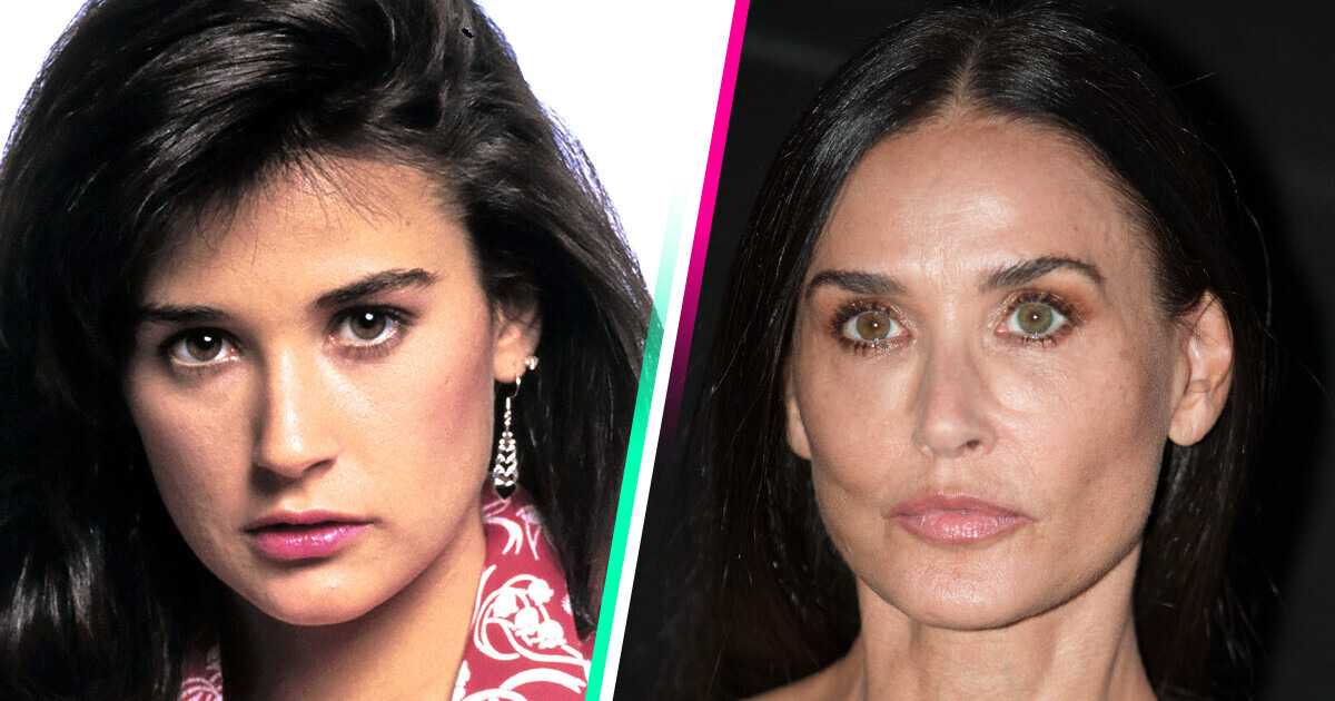 15 Celebrity Women Who Got Chiseled Cheekbones and Drastically Changed Their Face 15 Celebrity Women Who Got Chiseled Cheekbones and Drastically Changed Their Face