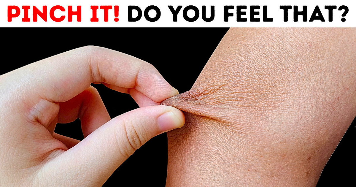 Pinch Your Elbow And Check What You Feel + 9 Funky Body Facts