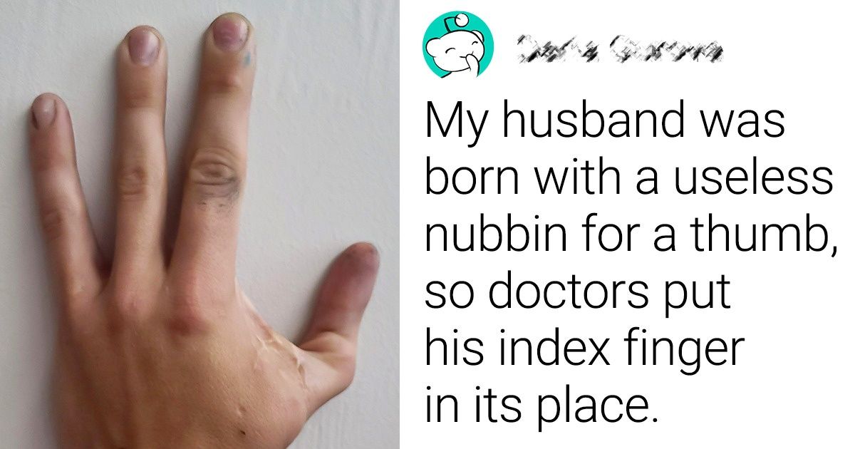 20 Unique Situations That Can Amaze Literally Anyone