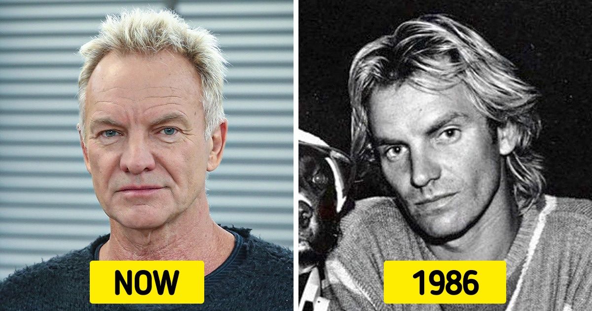 What 15 Mature Singers Looked Like When They Were Younger What 15 Mature Singers Looked Like When They Were Younger