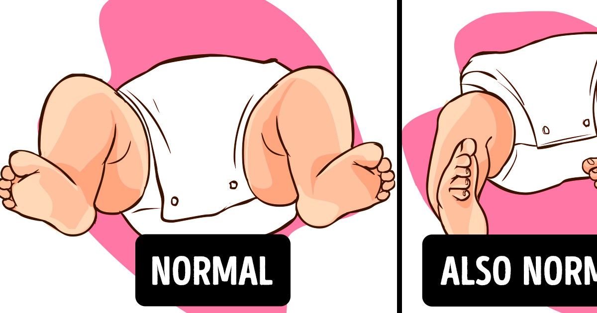 Leg Problems in Children That Parents Should Not Worry About Leg Problems in Children That Parents Should Not Worry About