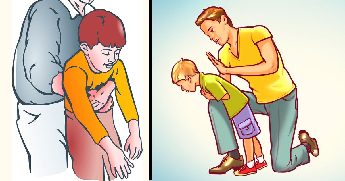 What to Do If Your Child Is Choking