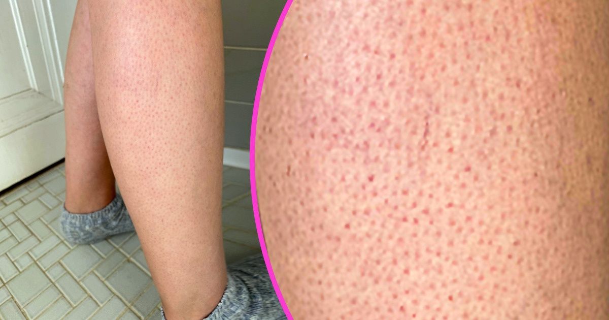 12 Peculiar Body Features That Cause Women to Worry for Nothing 12 Peculiar Body Features That Cause Women to Worry for Nothing
