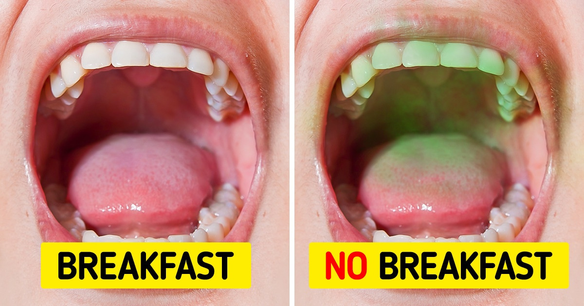 5 Things You Can Do to Get Fresh Breath