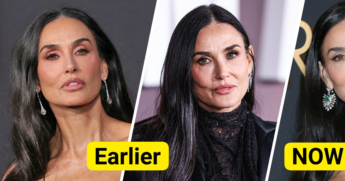 "Fillers Removed," Demi Moore Praised for Her Natural Appearance in Recent Look "Fillers Removed," Demi Moore Praised for Her Natural Appearance in Recent Look