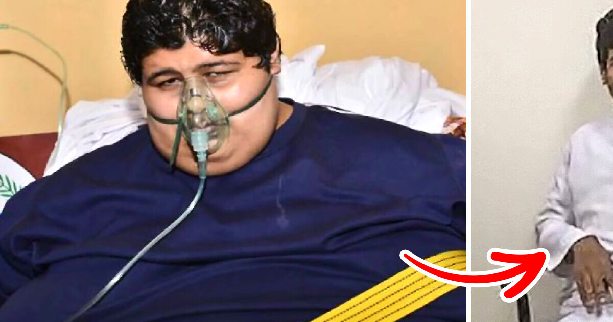 The Heaviest Teenager Who Used to Weigh Over 1300 Pounds Can Walk Again After Losing 700 lbs