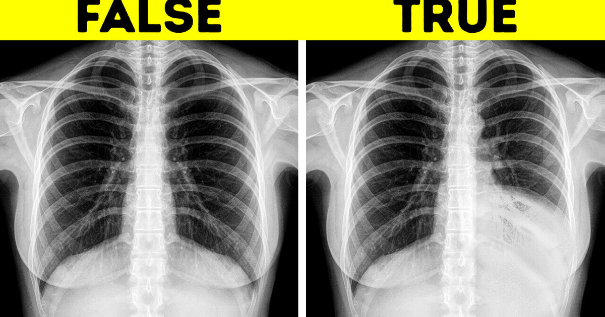 25 Bite-Sized Body Facts to Wow and Amaze 25 Bite-Sized Body Facts to Wow and Amaze