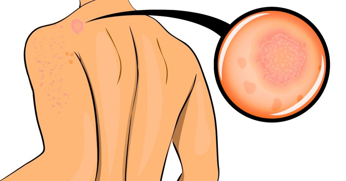 10 Important Signs That Your Body Is Very Stressed 10 Important Signs That Your Body Is Very Stressed