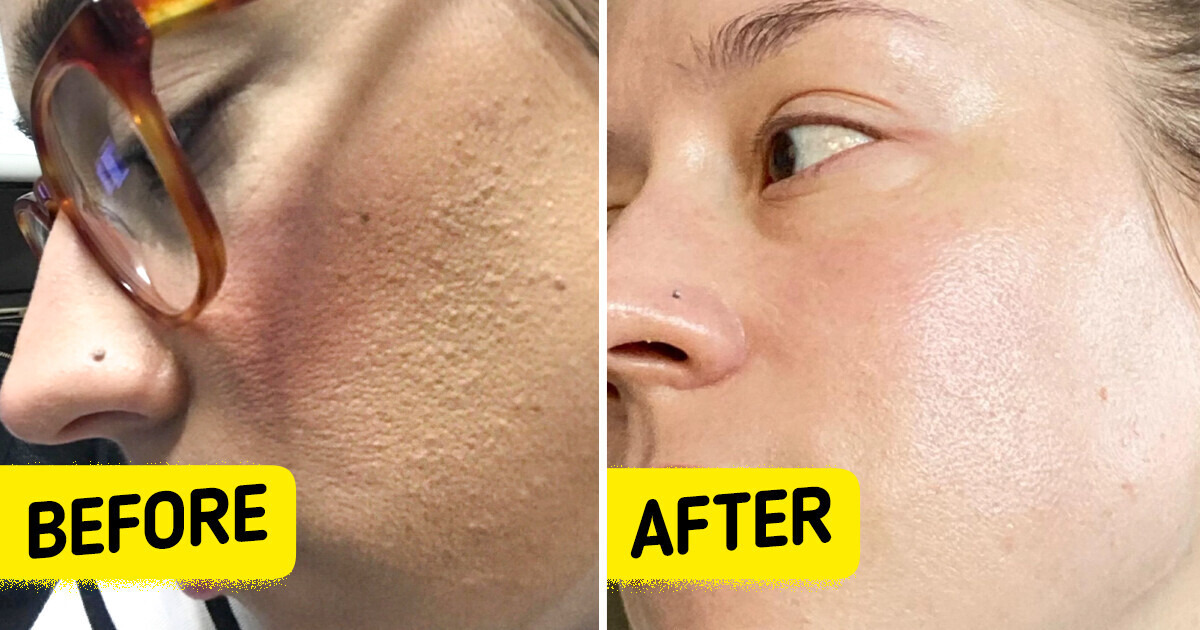 8 Days to Get Rid of Skin Defects and Problems, Dermatologists Swear by This Routine 8 Days to Get Rid of Skin Defects and Problems, Dermatologists Swear by This Routine