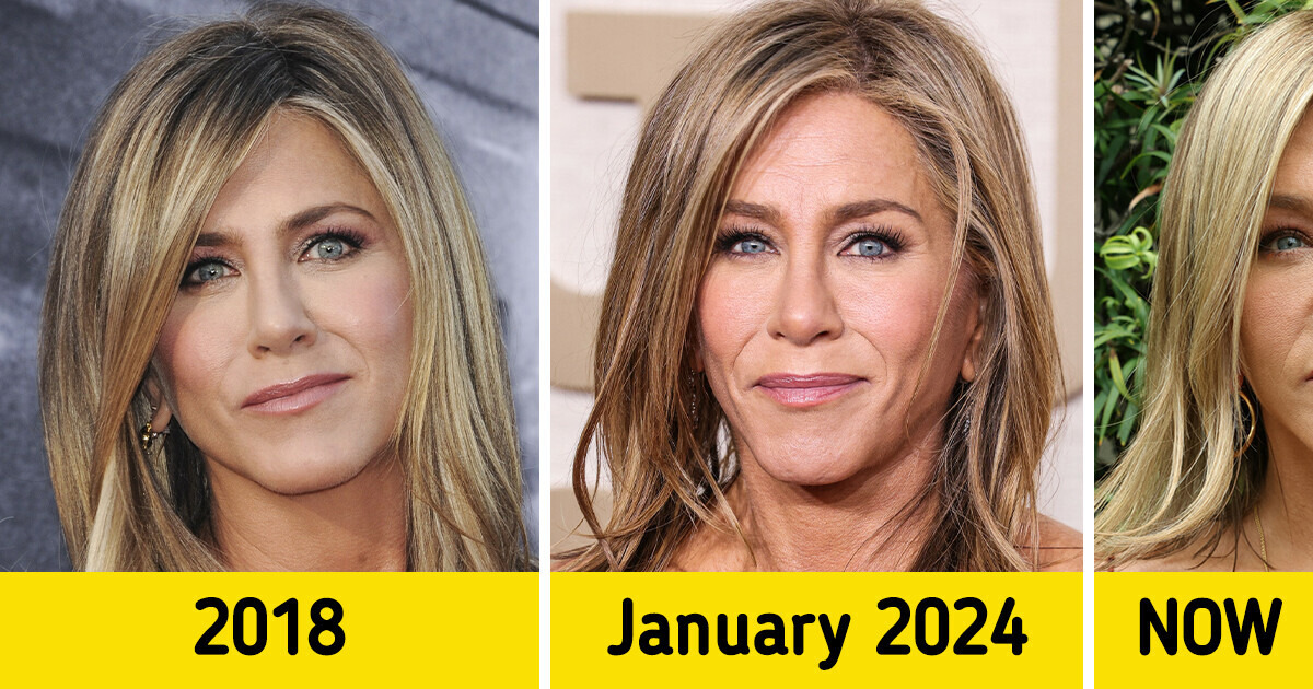 Why Jennifer Aniston’s Face Suddenly Started to Look Different Why Jennifer Aniston’s Face Suddenly Started to Look Different