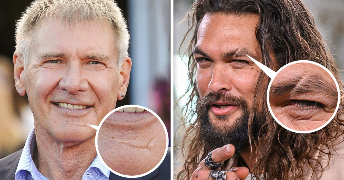 Men With Facial Scars Are More Attractive to Women, According to a Study Men With Facial Scars Are More Attractive to Women, According to a Study