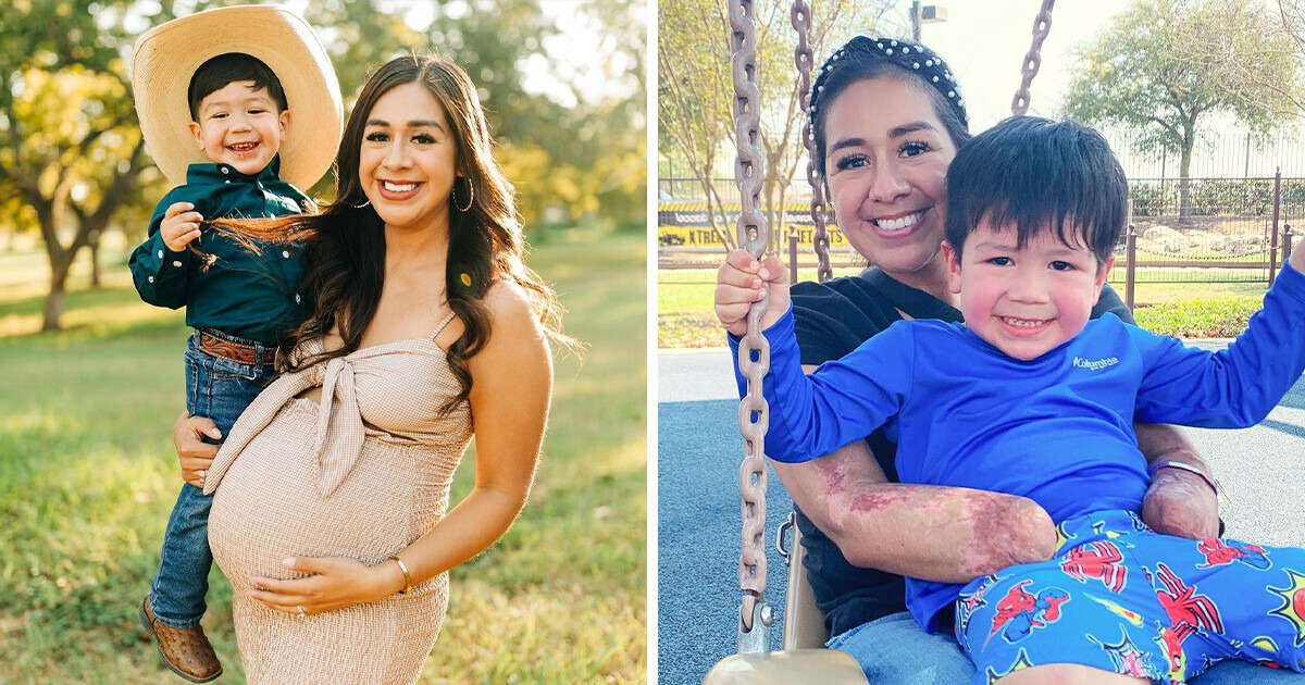 A Mother Loses Her Limbs After Giving Birth but Finds Solace in Her Baby’s Love A Mother Loses Her Limbs After Giving Birth but Finds Solace in Her Baby’s Love