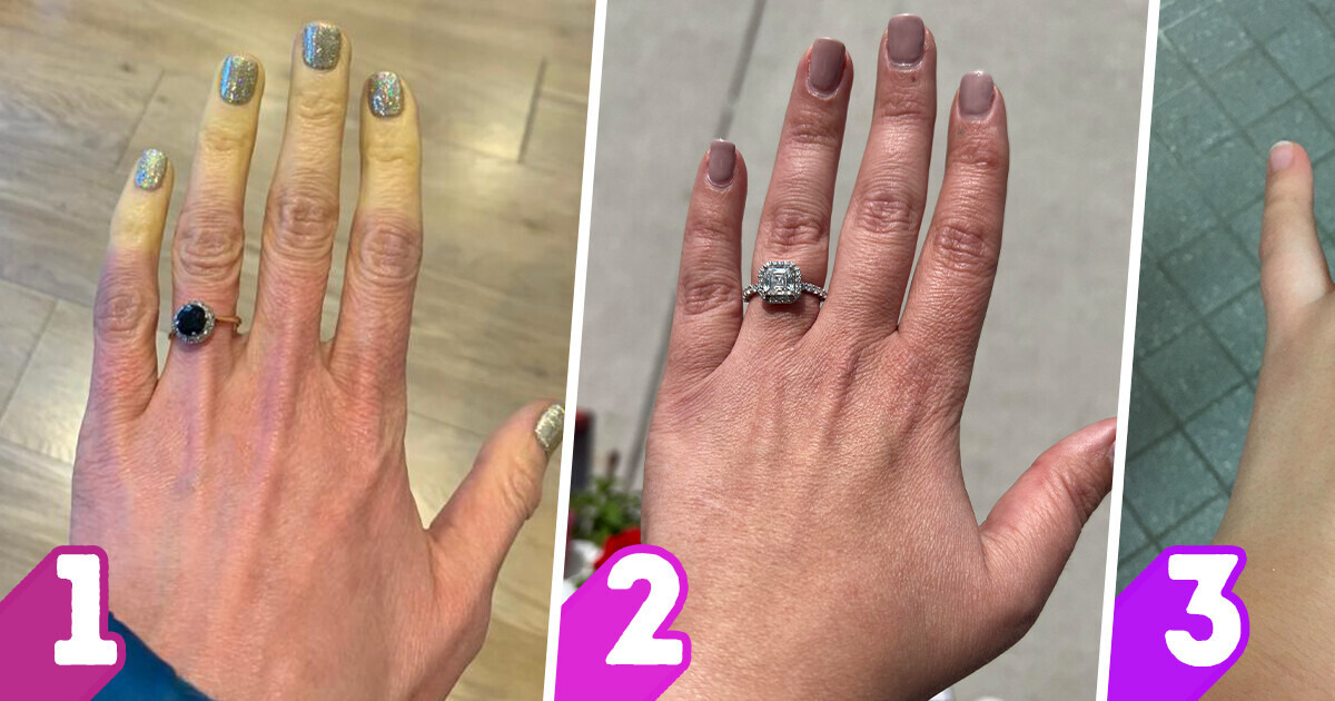 9 Warning Signs Your Hands Might Be Giving About Your Health 9 Warning Signs Your Hands Might Be Giving About Your Health