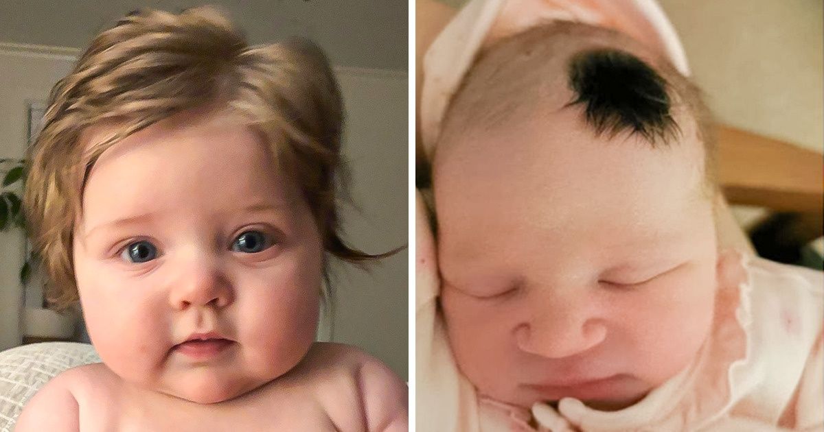 Why Some Babies Have Hair and Some Don't