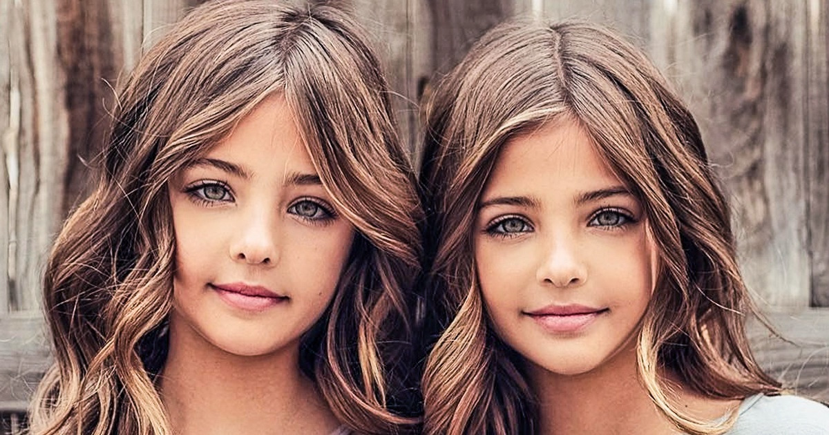 Two Sisters That Were Called The Most Beautiful Twins In The World