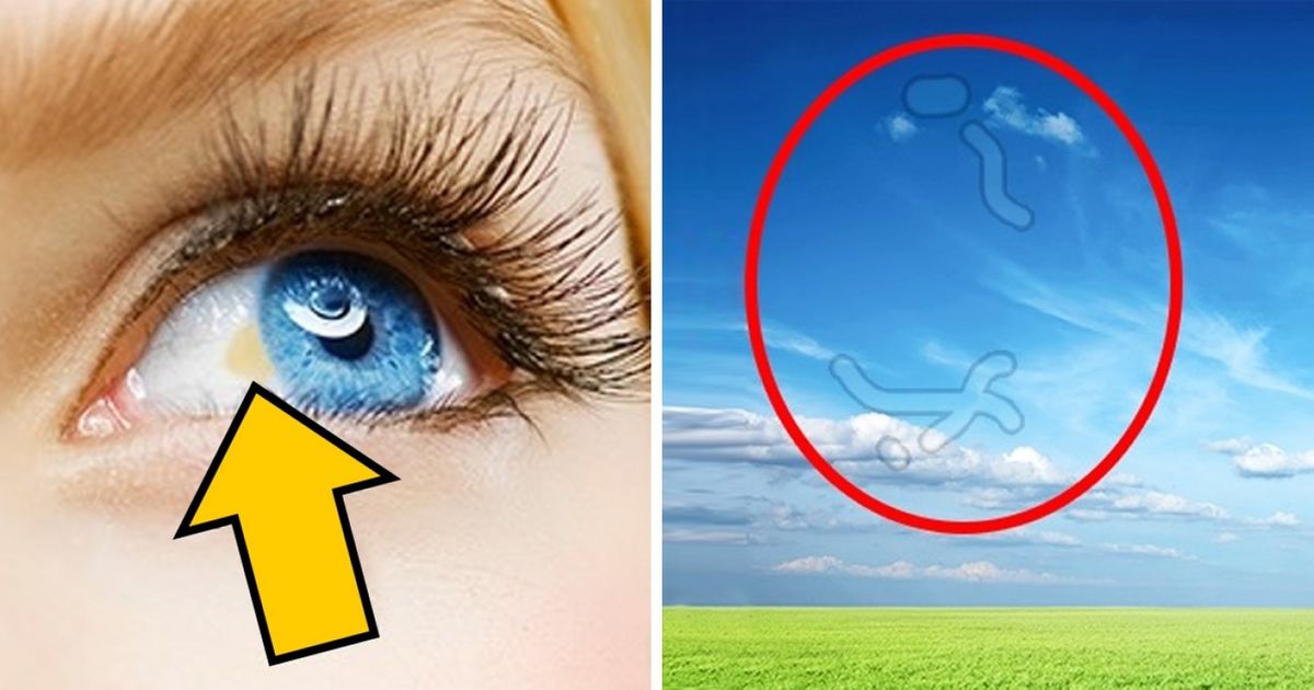 12 Things Your Eyes Can Tell About Your Health