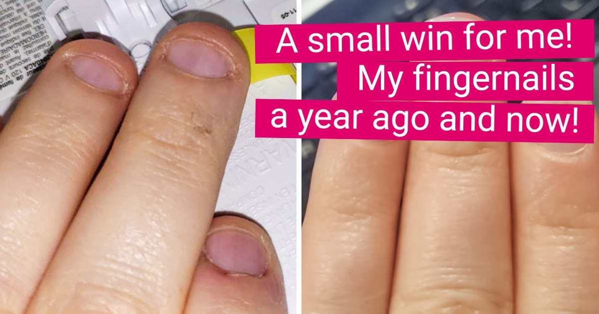 18 People Who Couldn’t Hide Their Happiest Moment and Shared It With the Entire Internet