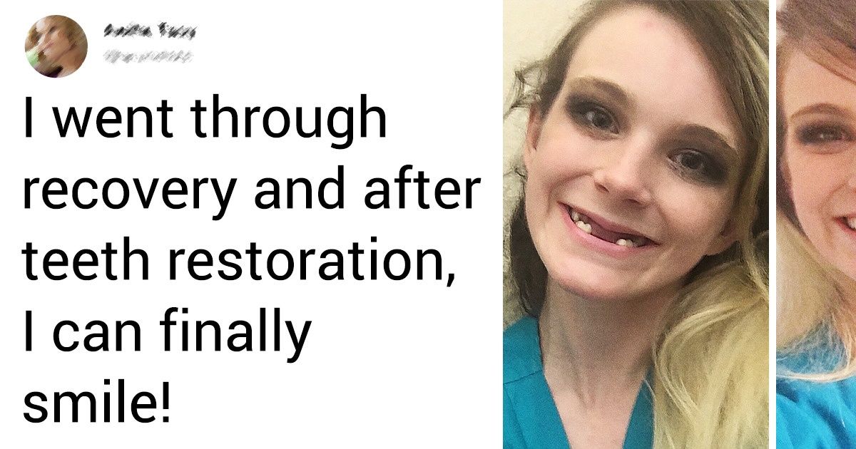 20 People Who Have Taken the Hard Way to a Healthy Body 20 People Who Have Taken the Hard Way to a Healthy Body