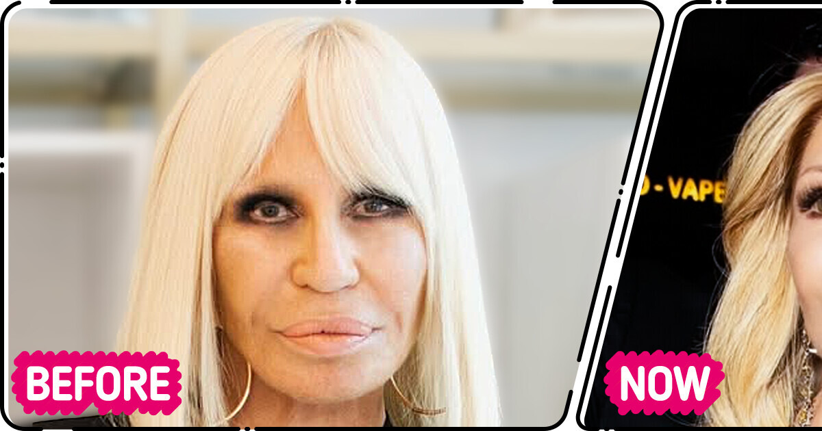 “That Surgeon Needs a Nobel Prize!” New Look of Donatella Versace Creates Online Stir “That Surgeon Needs a Nobel Prize!” New Look of Donatella Versace Creates Online Stir