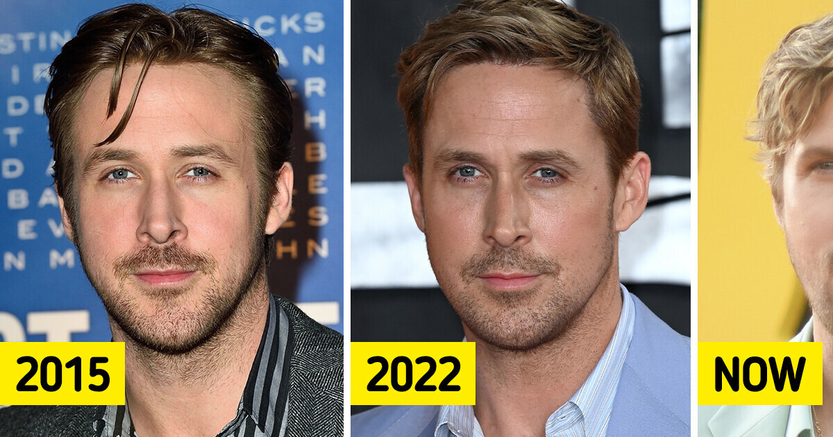 Ryan Gosling’s Face is “Ruined” By Fillers According to Shocked Fans Ryan Gosling’s Face is “Ruined” By Fillers According to Shocked Fans