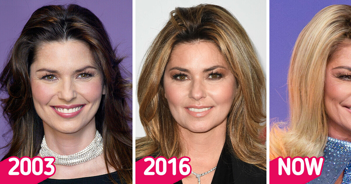 “What Happened to Her Face?” Shania Twain Surprises Fans Who Can’t Recognize Her