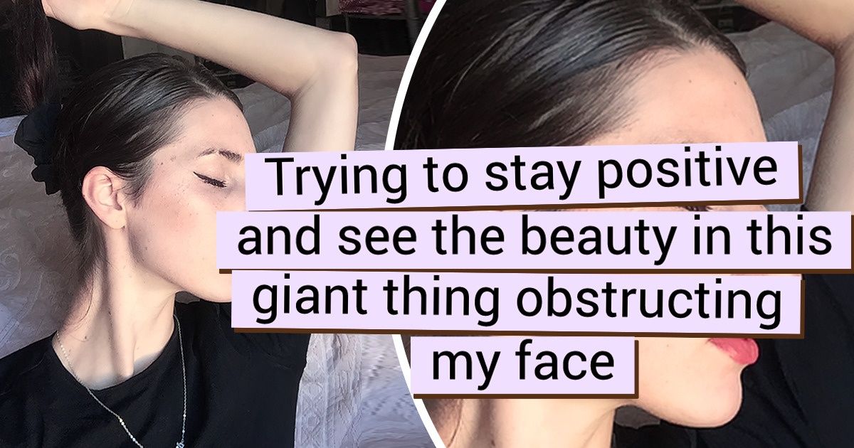 15 People Who Have Finally Accepted Their Appearance and Fallen in Love With Their Perfect Imperfections 15 People Who Have Finally Accepted Their Appearance and Fallen in Love With Their Perfect Imperfections