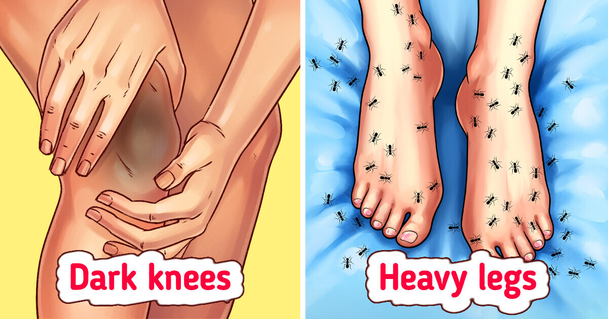 9 Warning Signs of Varicose Veins—Even If Your Legs Look Fine 9 Warning Signs of Varicose Veins—Even If Your Legs Look Fine