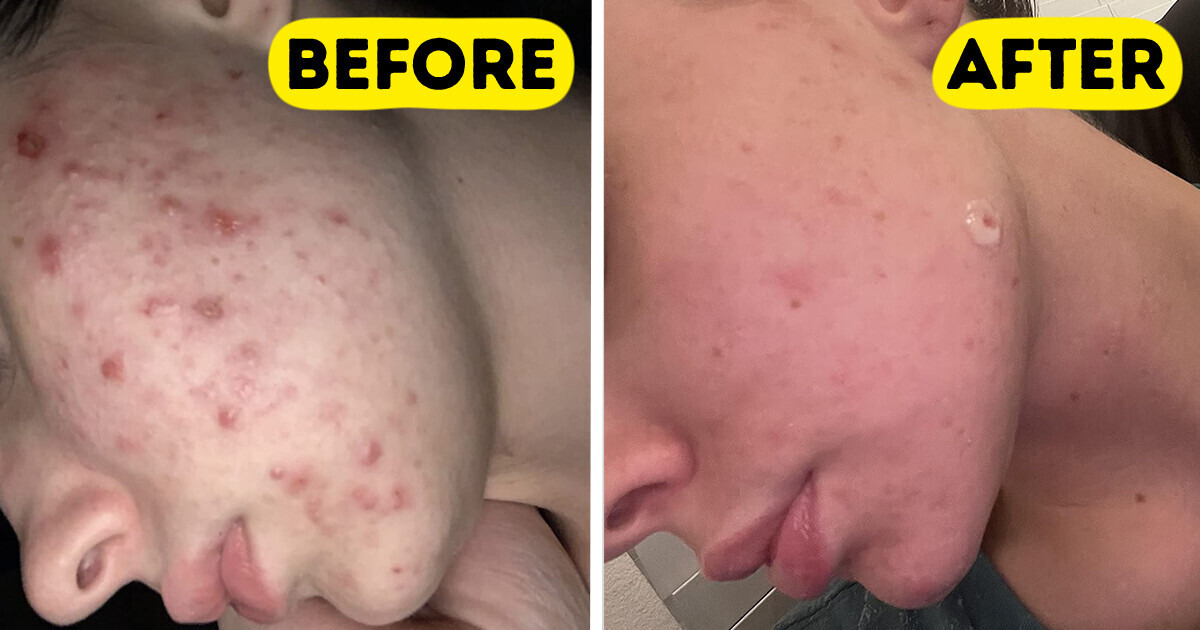 10 products from Amazon that are real must-haves for those who are fed up with skin issues 10 products from Amazon that are real must-haves for those who are fed up with skin issues