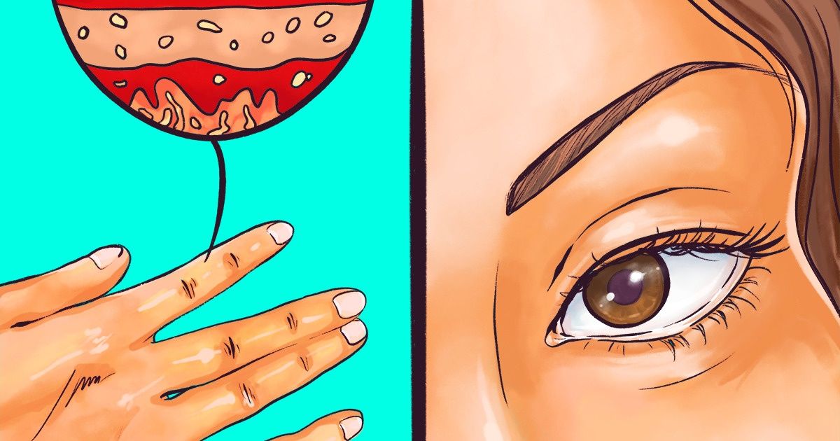 9 Signs That Your Thyroid Doesn’t Work Properly, and It Can Be Dangerous to Ignore Them
